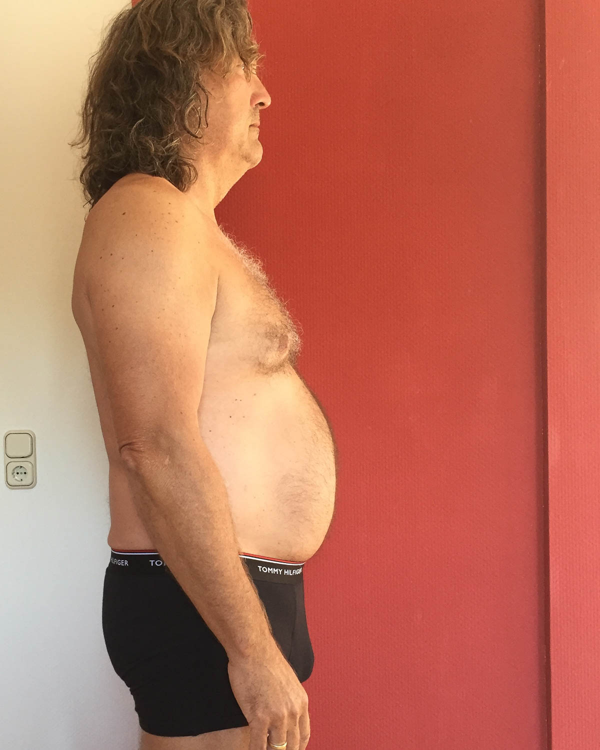 Lifeplus Stoffwechselkur Bruno vorher